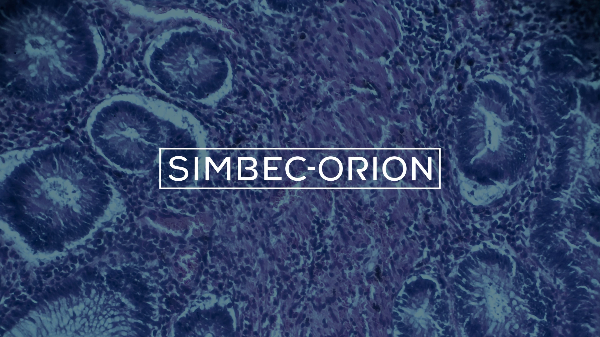 Simbec-Orion